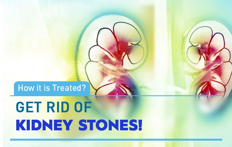 Kidney Stone Disease
